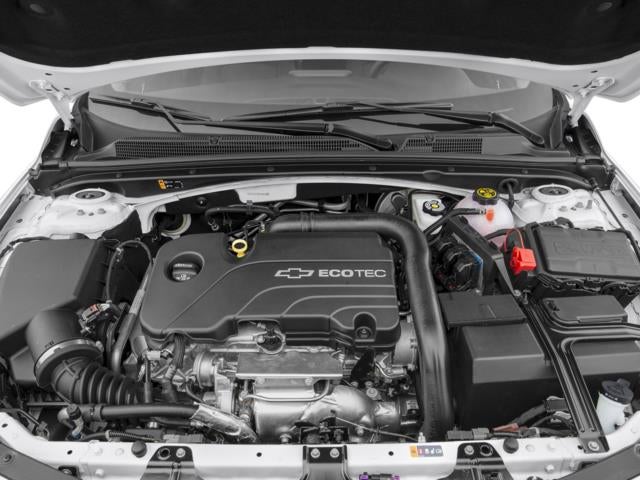 2017 Chevrolet Malibu 1LT